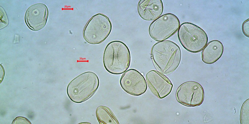 Mikroskopaufnahme von Weizenpollen.