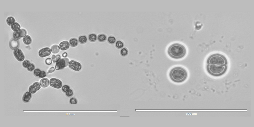 Microscopic image in black and white: two different types of blue-green algae.
